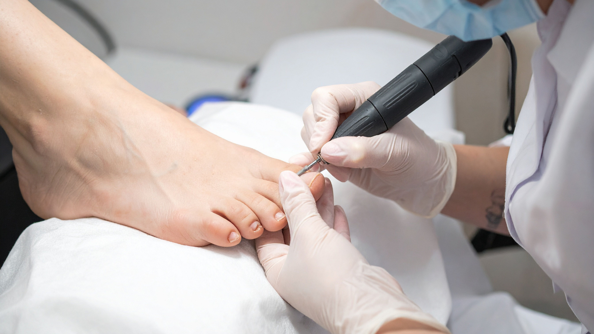 podiatry treatments in croydon