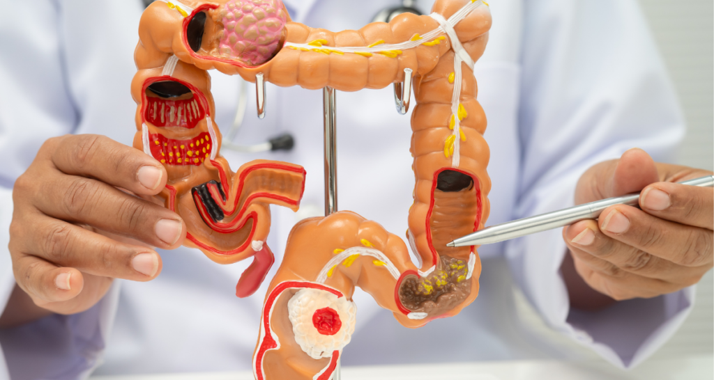 5 huge colonics benefits - medical massage detox - renda krown - croydon